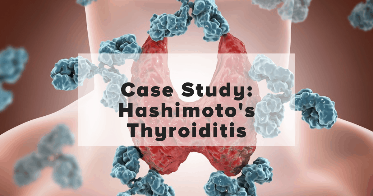 Case Study Hasimoto's thyroiditis